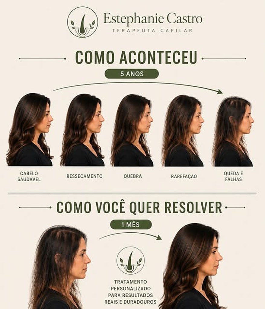 Ilustração da evolução do cabelo ao longo de cinco anos sem tratamento e a recuperação com protocolo personalizado
